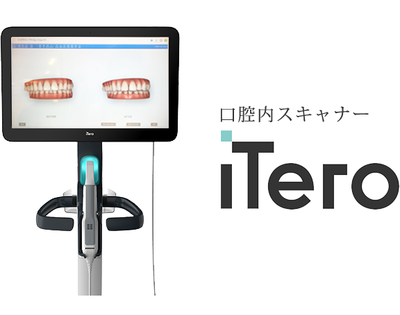 口腔内スキャナー「ITero」