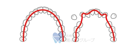 便宜抜歯