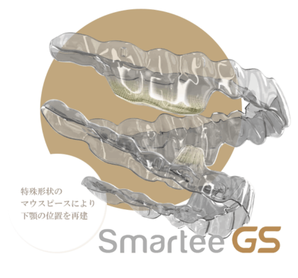 gs