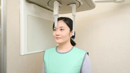 セファロ撮影
