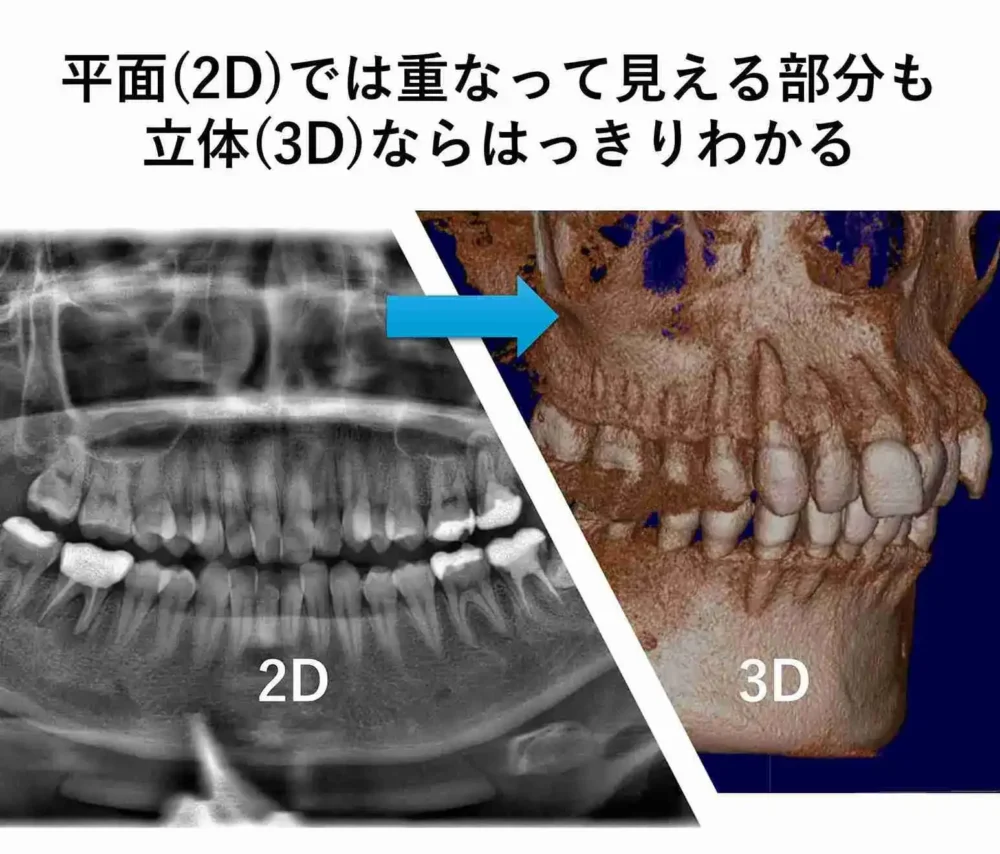 2Dと3Dの違い