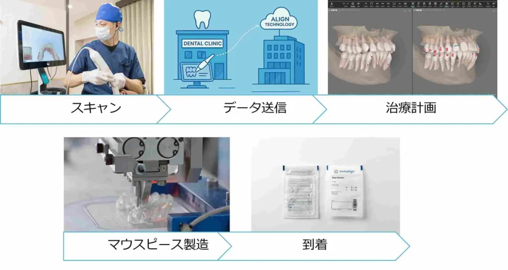 スキャンからインビザラインができるまでの流れ