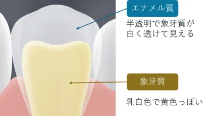 象牙質とエナメル質