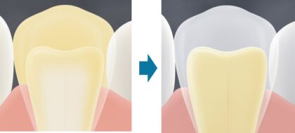 セルフホワイトニング作用