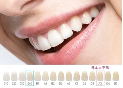 ブリーチシェード