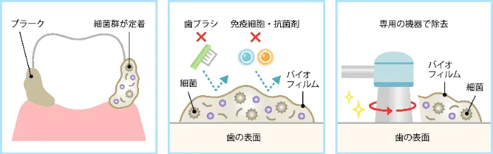 バイオフィルム
